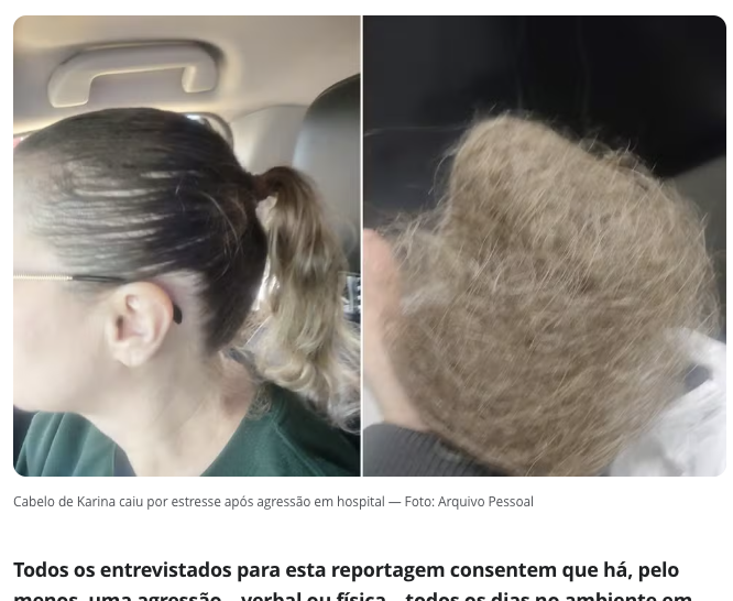 心的ストレスにより脱毛症を発症した医療従事者(13日付G1サイトの記事の一部)