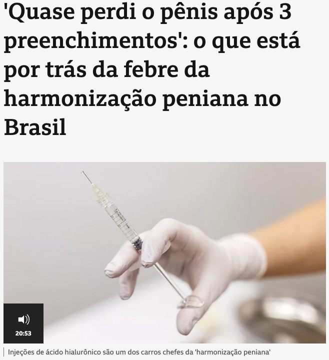 ブラジル人男性の陰茎増大術増加＝誇りと願望が生むリスクと代償