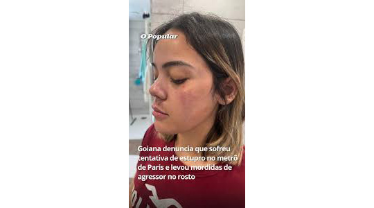 パリ郊外の電車内でブラジル人女性が強姦未遂被害に