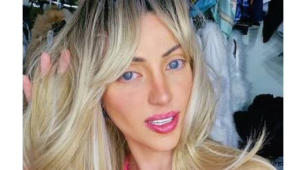 「人間バービー」、死因はコカインの過剰摂取だった