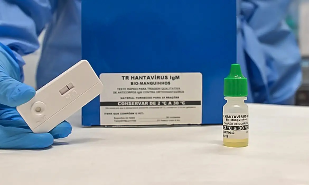 ハンタウイルス　写真