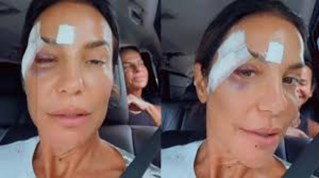 顔に傷も。イベッチ・サンガーロ、体調不良で緊急入院騒ぎ