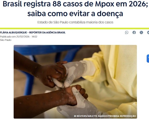 MPOX＝今年も既に88人の感染確認＝保健省が8連邦自治体に警告